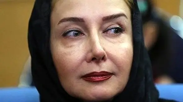  گرانترین عمل زیبایی کتایون ریاحی /  + عکس