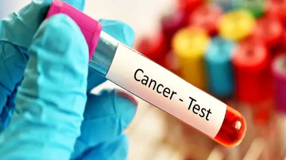 هشدار؛ سرطان کبد در انتظار این دسته از افراد است!