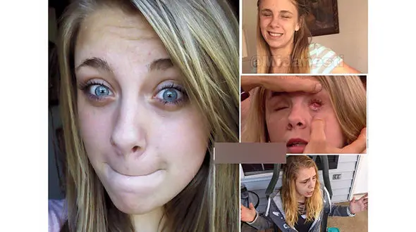 این دختر زیبا رو چشمانش را با دستان خود از کاسه درآورد+ عکس