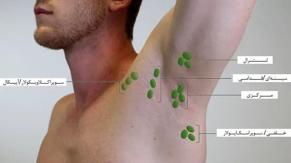 لنف نود چیست؟