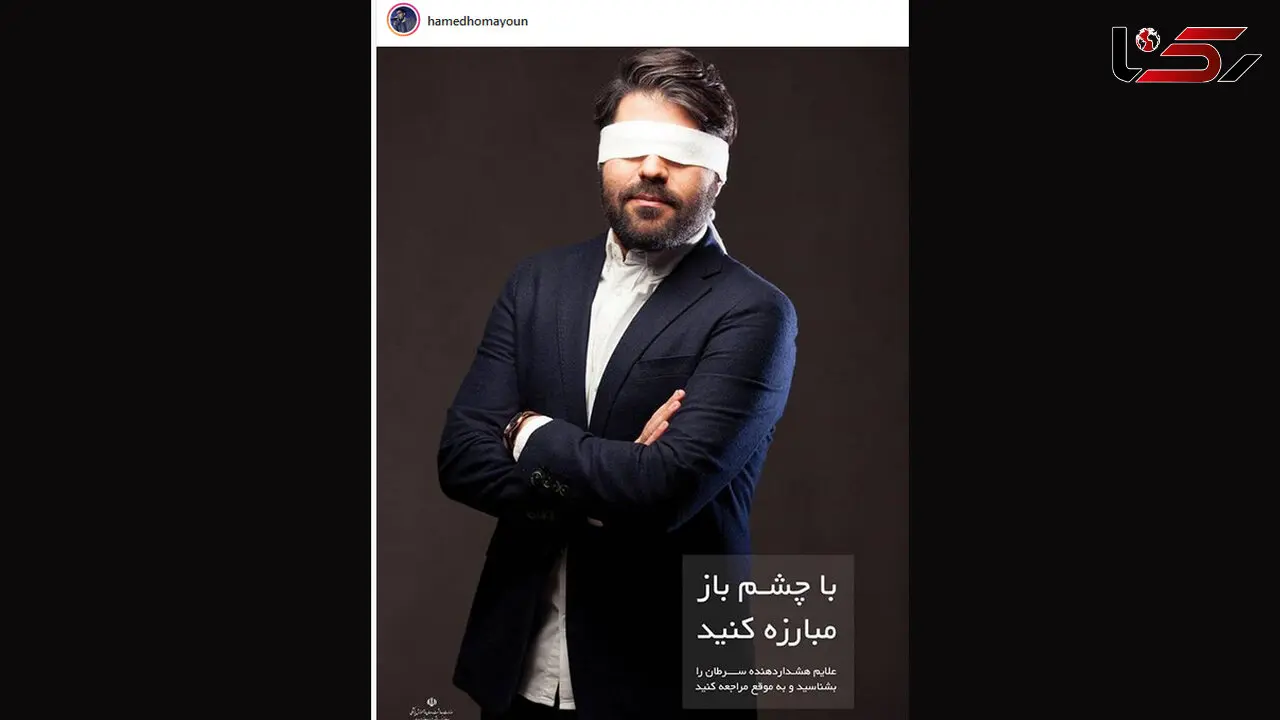 مبارزه «حامد همایون» با چشمان باز!