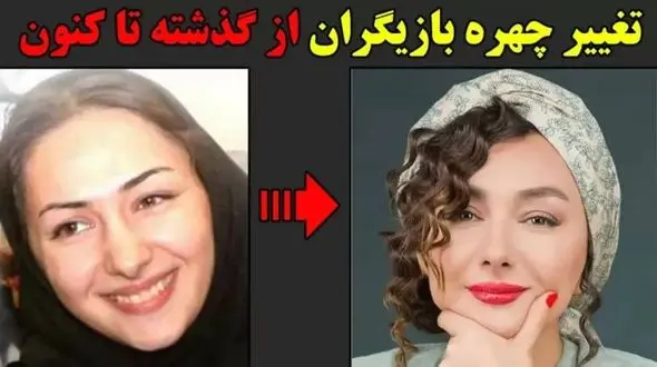 فیلم/ تغییر چهره 180 درجه ای  بازیگران زن مشهور بعد از عملهای زیبایی؛ سحر دولتشاهی، الناز حبیبی، نیوشا ضیغمی 