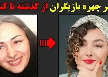 فیلم/ تغییر چهره 180 درجه ای  بازیگران زن مشهور بعد از عملهای زیبایی؛ سحر دولتشاهی، الناز حبیبی، نیوشا ضیغمی 