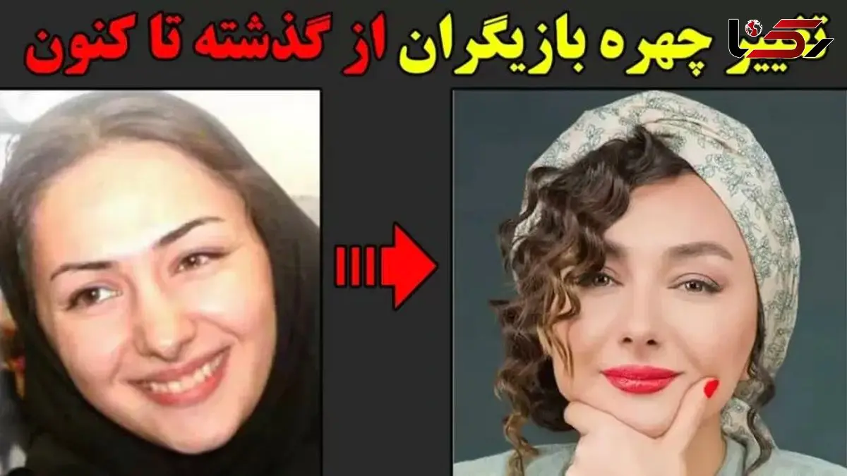 فیلم/ تغییر چهره 180 درجه ای  بازیگران زن مشهور بعد از عملهای زیبایی؛ سحر دولتشاهی، الناز حبیبی، نیوشا ضیغمی 