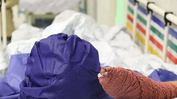 مچ هر دو دست یک مرد در شهرستان دورود قطع شد