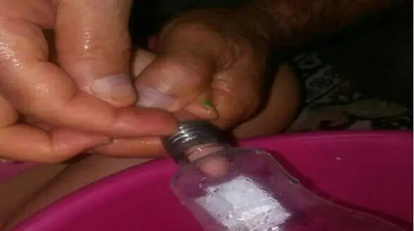 عکس / حادثه ای عجیب برای دختر 6 ساله بابلی