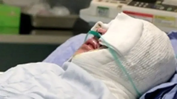 عروس جوان چهره امیر رضا داماد خوش قیافه گنابادی را سوزاند !