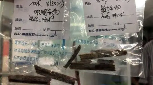 علت عجیب سردردهای 5 ساله مرد چینی+عکس