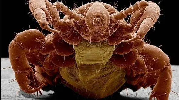 عکس صورت شپش سر زیر میکروسکوپ! / حتما ببینید