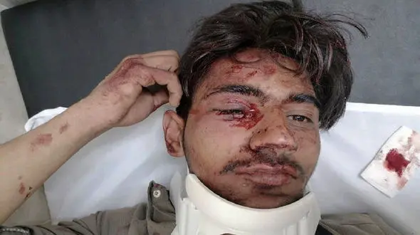 سقوط دانش آموز بیرجندی از کوه / او دنبال اینترنت بود +عکس 