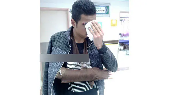 معلم عصبانی، دست دانش آموز نهبندانی را شکست! +عکس