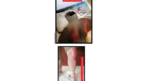 اسیدپاشی بادیگاردهای کمدین ایرانی روی یک مرد ! / در مشهد رخ داد + عکس ها و رای دادگاه