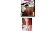 اسیدپاشی بادیگاردهای کمدین ایرانی روی یک مرد ! / در مشهد رخ داد + عکس ها و رای دادگاه