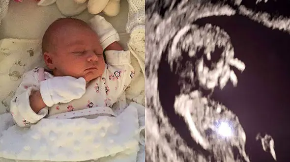 این زن یک پرنده باردار بود! + عکس