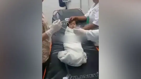 این کودک سکه قورت داد + فیلم نجات کودک