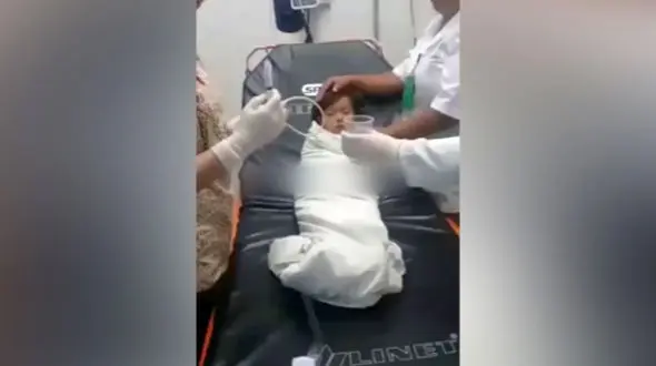 این کودک سکه قورت داد + فیلم نجات کودک