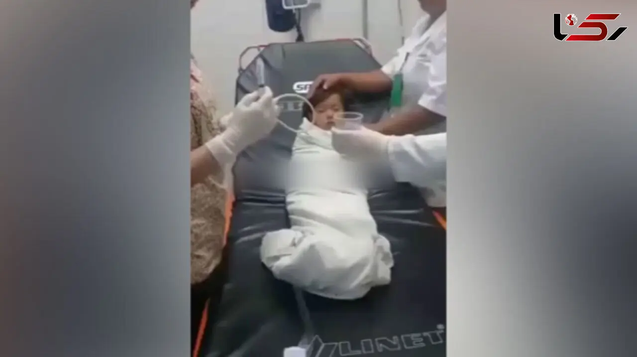 این کودک سکه قورت داد + فیلم نجات کودک