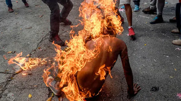 تصاویری دلخراش از سوختن مرد جوان + 14+