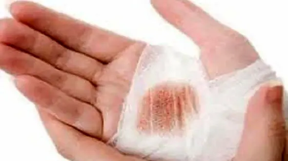 آتش سوزی آزمایشگاه مدرسه طراوت بجنورد / دانش آموز و مسئول آزمایشگاه سوختند