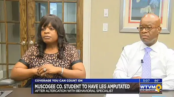 معلم بی‌رحم باعث قطع پای یک دانش آموز شد+عکس