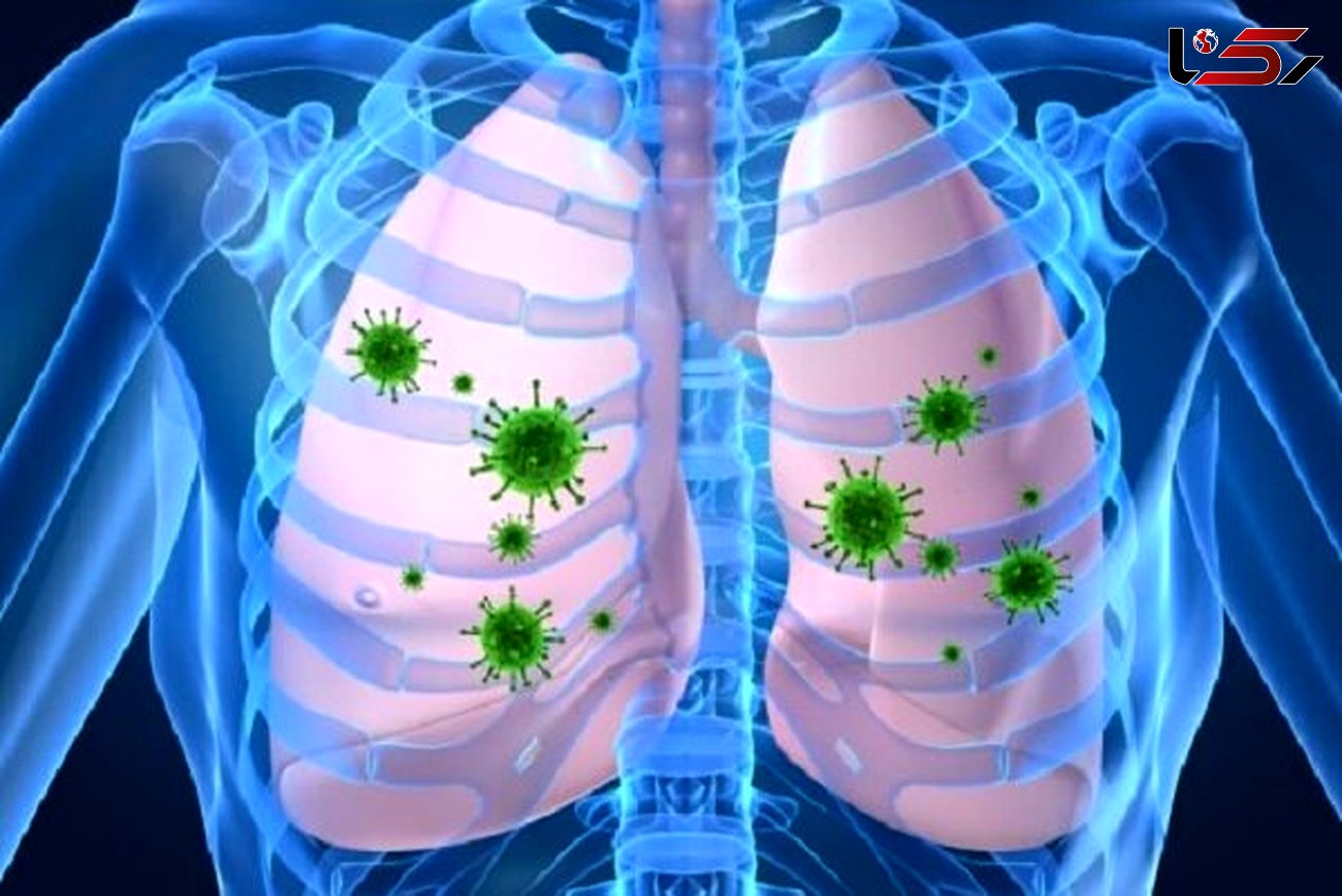 تاثیر تغییرات اقلیمی در افزایش شیوع عفونت های تنفسی