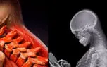 نکات طلایی برای محافظت از گردن هنگام استفاده از موبایل / فیلم