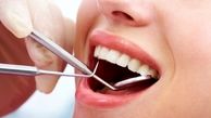 چاقی با پوسیدگی زودهنگام دندان ها ارتباط دارد