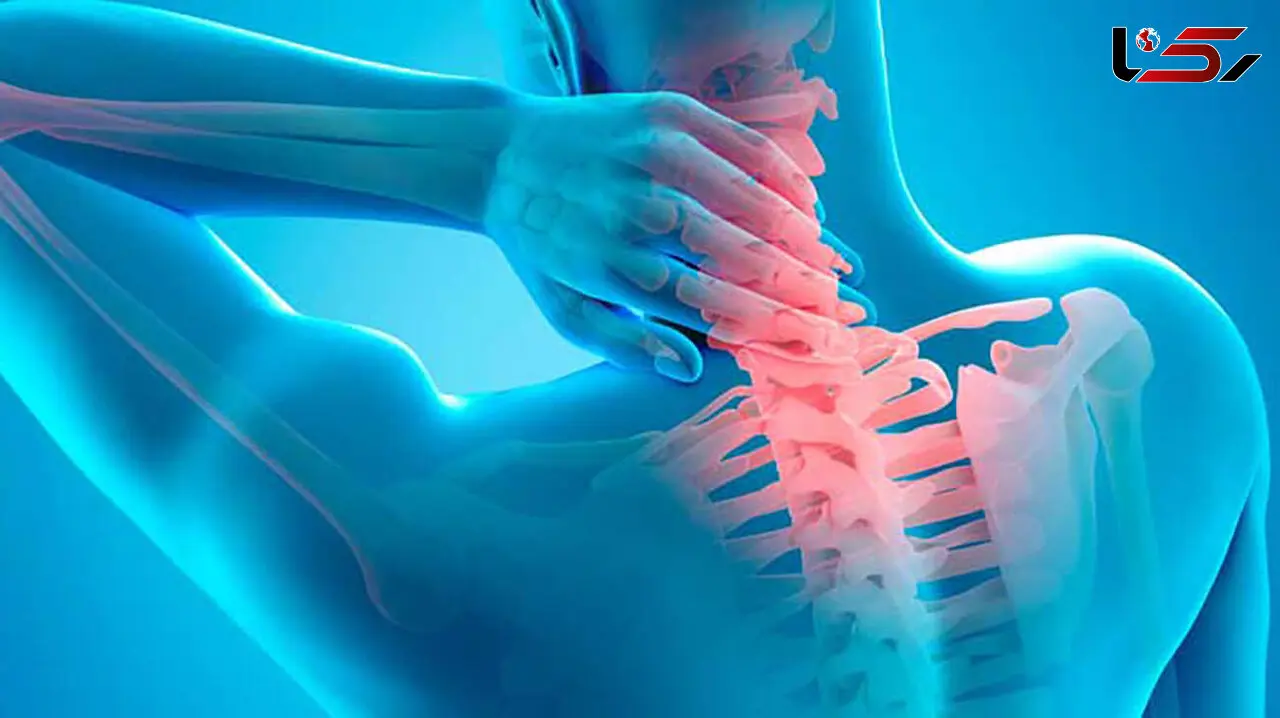 آرتروز گردن را با این حرکات ورزشی از بین ببرید