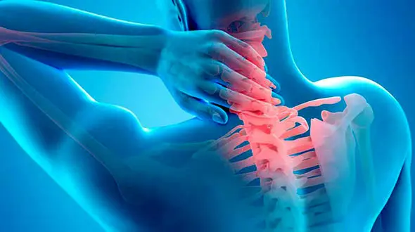 آرتروز گردن را با این حرکات ورزشی از بین ببرید