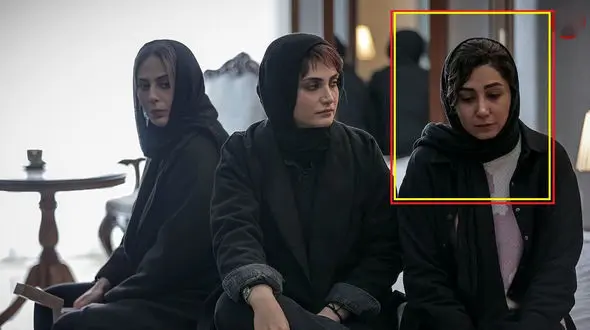 تغییر چهره دیدنی «فرناز طلوعی» سریال زخم کاری در 35 سالگی