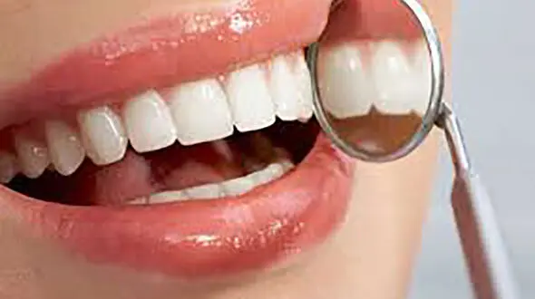 پیشنهادهایی برای زیبایی دندان‌ها 