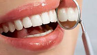 پیشنهادهایی برای زیبایی دندان‌ها 