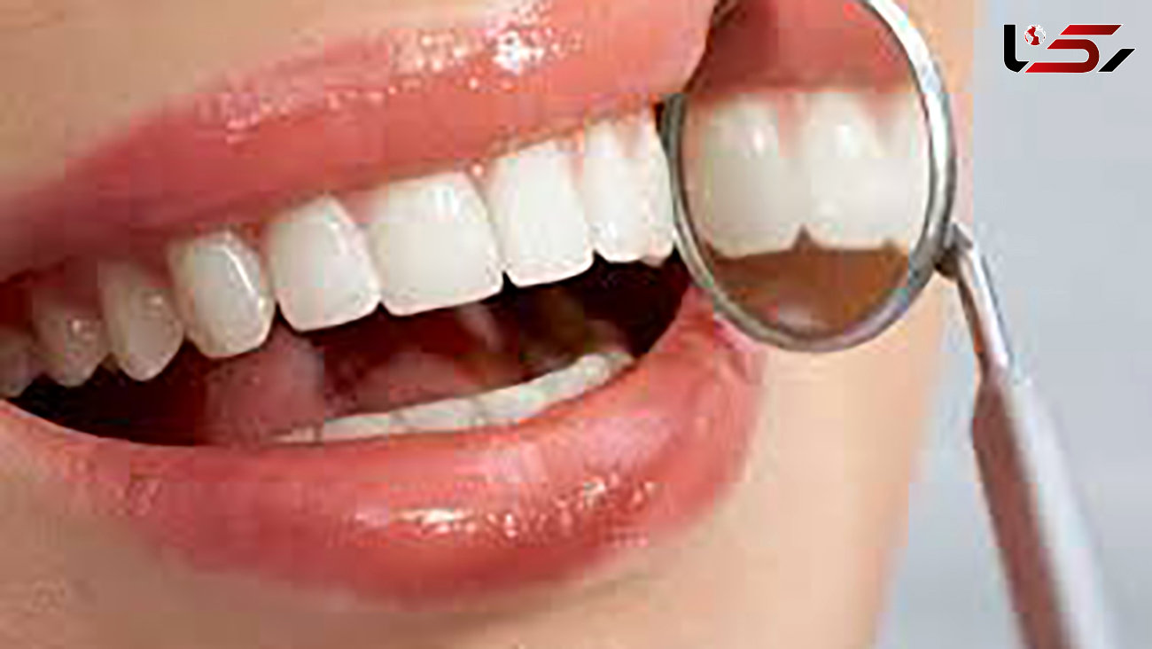 پیشنهادهایی برای زیبایی دندان‌ها 