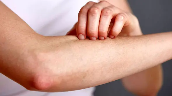 نشانه های این بیماری خطرناک را بشناسید