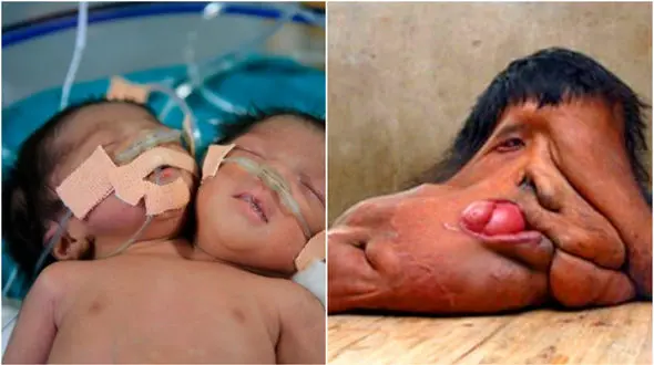 انسان های عجیب و غریب و ترسناک دنیا + عکس های 18+