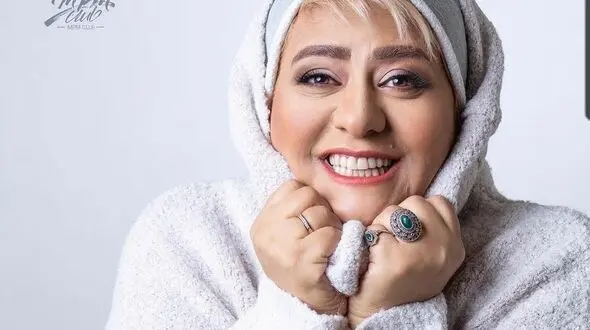 ‍رابعه اسکویی با تیپ سفید برفی جوان تر از قبل شد +عکس