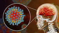 خطر سکته مغزی با کرونا ویروس