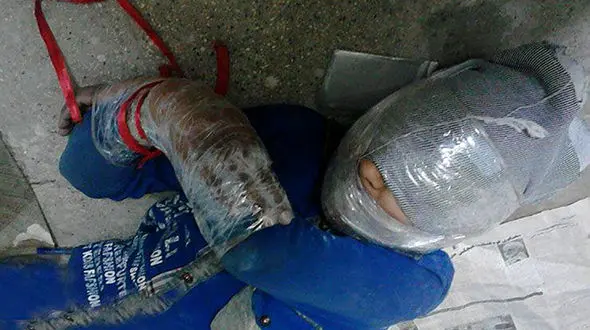 عکس تلخ / بلای وحشتناکی که خواستگار بر سر برادر 10 ساله دختر آورد / در تهران رخ داد