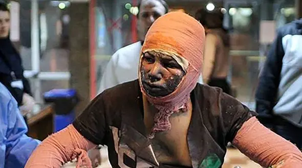 انتقال فوری 6 مجروح چهارشنبه سوری به بیمارستان مطهری تهران