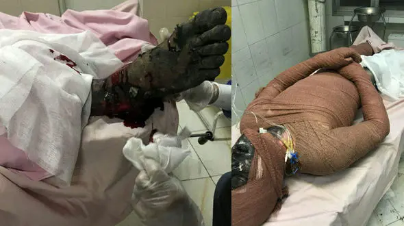 فاجعه در چهارشنبه سوری کرونایی ادامه داد / ۲ کشته و ۱۸۷ مصدوم