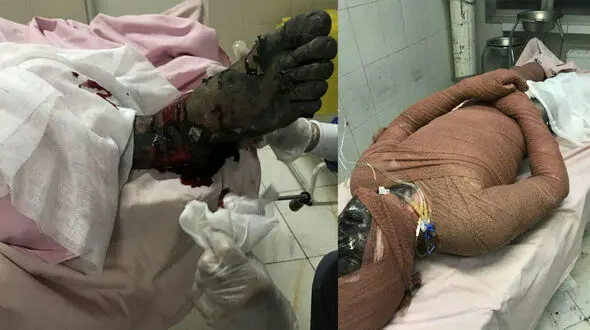 فاجعه در چهارشنبه سوری کرونایی ادامه داد / ۲ کشته و ۱۸۷ مصدوم