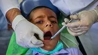 خیز وزارت بهداشت برای اجرای پیمایش ملی سلامت دهان و دندان دانش‌آموزان
