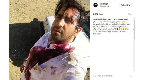 خواننده معروف آغشته  به خون شد +عکس