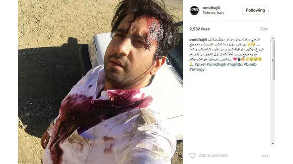 خواننده معروف آغشته  به خون شد +عکس