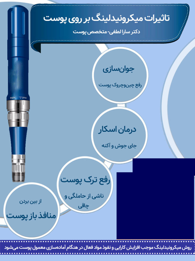 مزایای میکرونیدلینگ