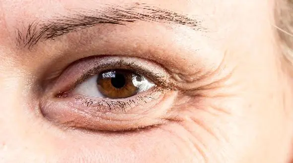 آیا می‌ دانید چرا پوست با گذر زمان چروک می‌ خورد؟ پاسخ علمی این پرسش