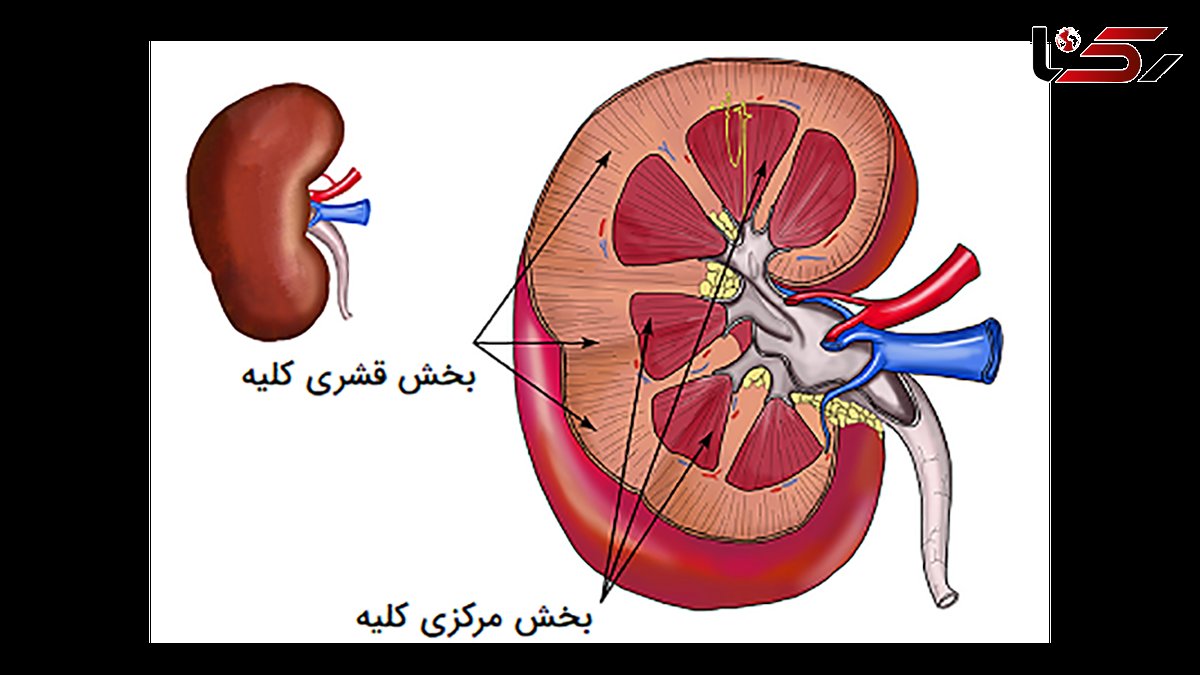 علائم ضعف کلیه ها و راهکارهای درمانی / اینفوگرافی