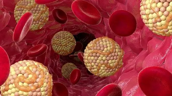 یائسگی و بالا رفتن کلسترول