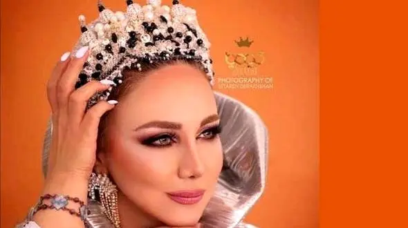 این عکس از چهره بهنوش بختیاری شما را شوکه می کند / عمل های خانم دیگر بازیگر بی تاثیر است !