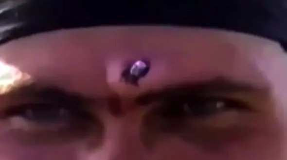 بیرون کشیدن گلوله کلاشنیکف از پیشانی سرباز با انبردست! + فیلم / روسیه